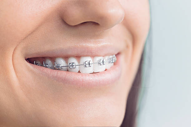 Best Dental Inlays and Onlays  in Broussard, LA
